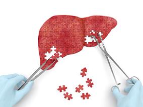 英夫利西单抗诱导的肝损伤：临床表型、自体免疫和糖皮质激素治疗的作用