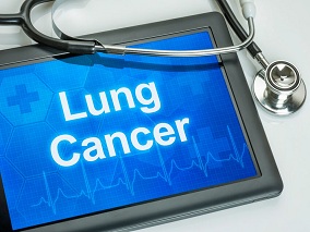 【肺癌进展报告2022】双免疫一线治疗晚期NSCLC 5年数据出炉 优势依旧