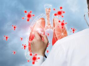 IV期NSCLC 帕博利珠单抗Q6W与Q3W给药疗效不相上下