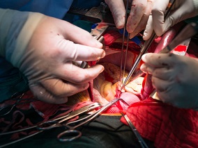 主动脉瓣狭窄患者行主动脉瓣置换术后 持续吃2类药物能降低死亡风险