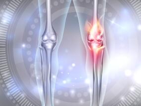 膝骨关节炎 黏弹性补充疗法有效吗？