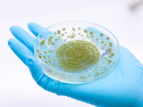 澳大利亚和新西兰成年患者侵袭性曲霉菌病的流行病学调查