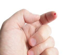 ECCMID 2023：一个干血斑可同时检测艾滋、乙肝和丙肝