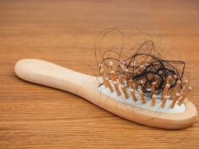 eDelphi共识更新：低剂量口服米诺地尔可用于治疗脱发