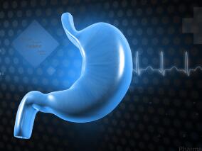研究发现，袖状胃切除术或可提高晚期CKD伴肥胖患者的肾移植资格